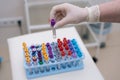 Close-up of doctor wearing medical glove taking tubes for blood test.