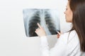 Close up doctor woman with X-ray of lungs, fluorography, roentgen isolated on white background. Female doctor in medical