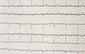 Close up of ECG electrocardiogram paper