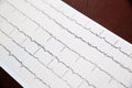 Close up of ECG electrocardiogram paper