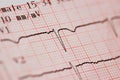 Close up of ecg graph Royalty Free Stock Photo