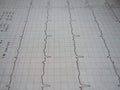 Close up of ECG graph