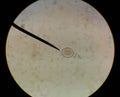 Close up egg with adult of parasite. Royalty Free Stock Photo