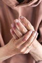 Woman hands with atopic dermatitis, eczema, allergy reaction on skin Royalty Free Stock Photo