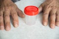 Close-up of an elderly man`s hand and a container for collecting urine and feces. Caring for health in old age.