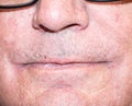 Close-up of an elderly person's lips with wrinkles