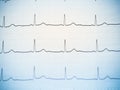 Close up of an electrocardiogram.