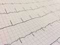 Close up of Electrocardiogram, Electrocardiography or EKG chart. Royalty Free Stock Photo