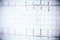 Electrocardiogram close up