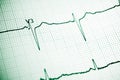 Electrocardiogram close up