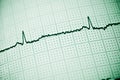 Electrocardiogram close up