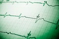 Electrocardiograph close up