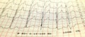 ECG Printout Showing Cardiac Waveforms on Medical Grid Paper Royalty Free Stock Photo