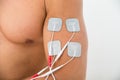 Close-up of electrodes on arm Royalty Free Stock Photo