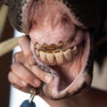 Excessively worn incisor teeth on a horse