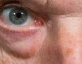 Close up of eye senior caucasian man Royalty Free Stock Photo