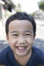 Close up face of asian boy with funny milk tooth