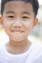 Close up face of asian children tooth smiling face