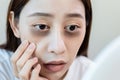 Close up face of asian young female stress looking mirror check have dark eye circles on face from staying up sleepy late. from