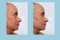 Close-up face of elderly bald tanned man 60 years old looking to the side, profile, before and after cosmetic procedures, wrinkles Royalty Free Stock Photo