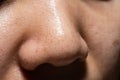 Close-up face women show the small pimple blackheads on skin of nose Royalty Free Stock Photo