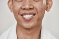 Close up of face of young man with problematic skin smiling after brushing his teeth with the foam of toothpaste left in