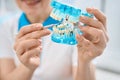 Female dental technician showing tooth with caries or decay on 3d model Royalty Free Stock Photo