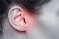 Closeup of female ear with source of pain Royalty Free Stock Photo