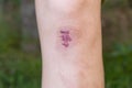 Close up of female knee with a scar Royalty Free Stock Photo