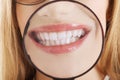 Close up on female's teeth through magnyfying glass. Royalty Free Stock Photo
