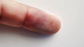 Close-up of a fingerprint pattern on a human finger