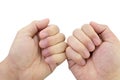 Close-up of fingers and nails with dry skin, torn and flaking off Royalty Free Stock Photo