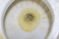 Close-up of foamy urine in the toilet.