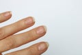 four dirty hand nails on white background Royalty Free Stock Photo