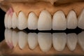 Close-up front view of a dental upper jaw prosthesis on black glass background. Artificial jaw with veneers and crowns