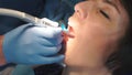 Close-up of a girl drilling teeth at a dental clinic