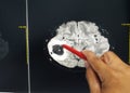 Hand doctor holding a red pen tells the patient the examination mri brain finding brain tumor or mass .Medical concept, b