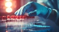 close up hand of Doctor, nurse taking blood sample from patient\'s arm, blood test, injection, probe vein blood Royalty Free Stock Photo