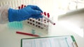 Close-up of the hand of a laboratory assistant registering samples. Laboratory studies of coronavirus infection. Search