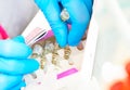 Close-up hands of young woman doctor anesthesiologist dressed in pink gown, blue gloves prepares solution for anesthesia