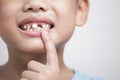 Close up headshot cropped image little preschool cute boy widely smilin showing empty space