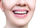 Close-up healthy smile of young woman. Perfect white teeth. Royalty Free Stock Photo