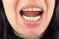 Close up of healthy teeth of young woman. Dental health care. Hygiene teeth. Dentistry