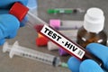 HIV test in close-up Royalty Free Stock Photo