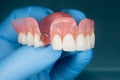 Close-up human denture of the upper jaw on a blue background in the hand of a dentist wearing a medical glove