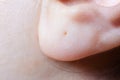A close-up of the human earlobe. Macro photo of a pierced ear in a woman