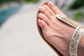 Close up of human foot finger with a blister