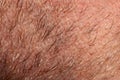 Close-up of human skin