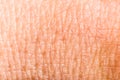 Close up human skin. Macro epidermis Royalty Free Stock Photo