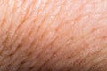 Close up human skin. Macro epidermis Royalty Free Stock Photo